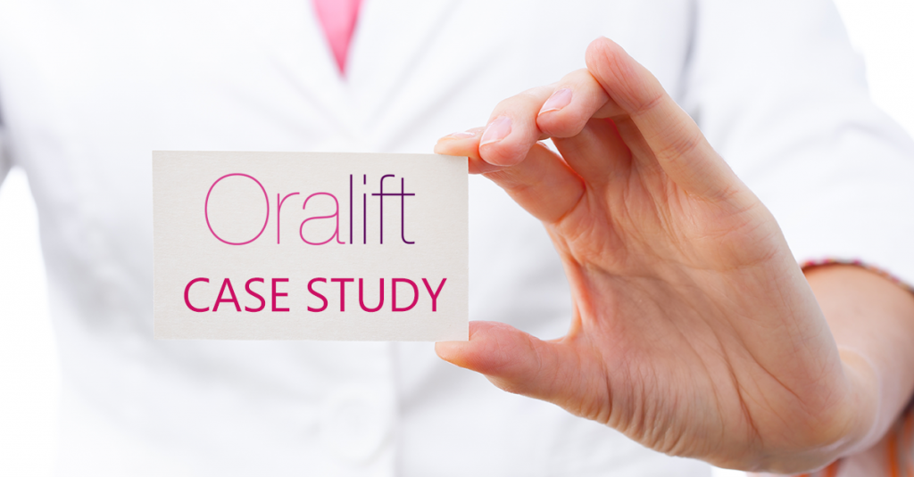 fb_case_study